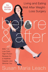 Title: Before & After: Living and Eating Well After Weight-Loss Surgery, Author: Susan Maria Leach