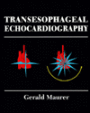 Transesophageal Echocardiography / Edition 1