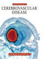 Principles of Cerebrovascular Disease / Edition 1