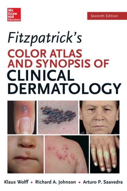 Fitzpatricks Color Atlas And Synopsis Of Clinical Dermatology Seventh Edition By Klaus Wolff 6077