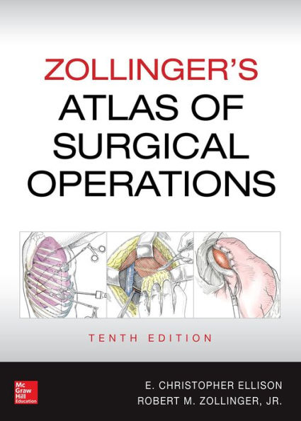 Zollinger's Atlas of Surgical Operations, 10th edition