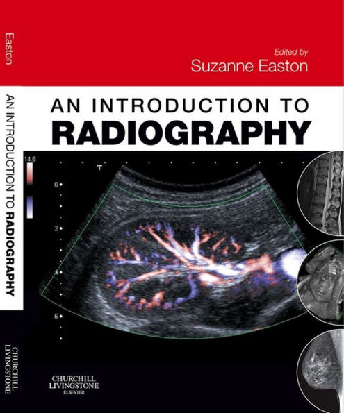 An Introduction to Radiography E-Book: An Introduction to Radiography E-Book