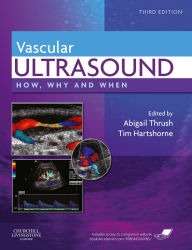 Title: Vascular Ultrasound: How, Why and When, Author: Abigail Thrush