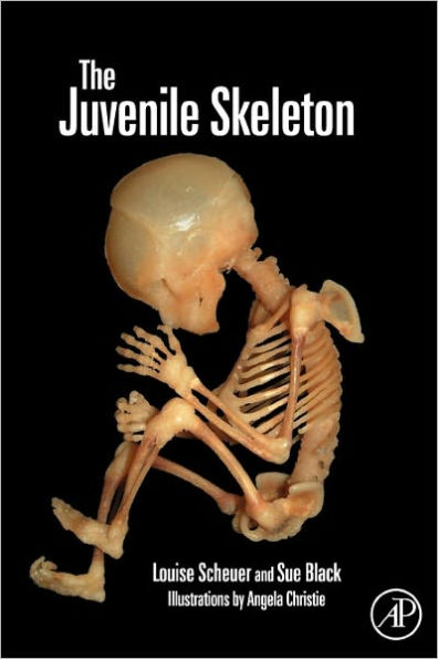 The Juvenile Skeleton