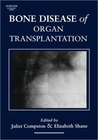 Title: Bone Disease of Organ Transplantation, Author: Juliet Compston