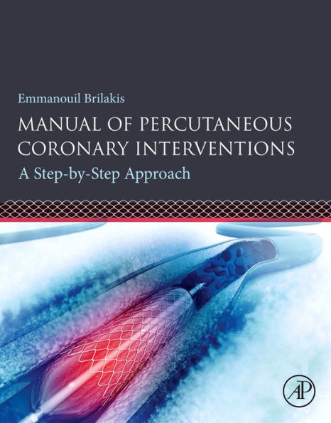 Manual of Percutaneous Coronary Interventions: A Step-by-Step Approach