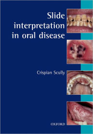 Slide Interpretation in Oral Diseases
