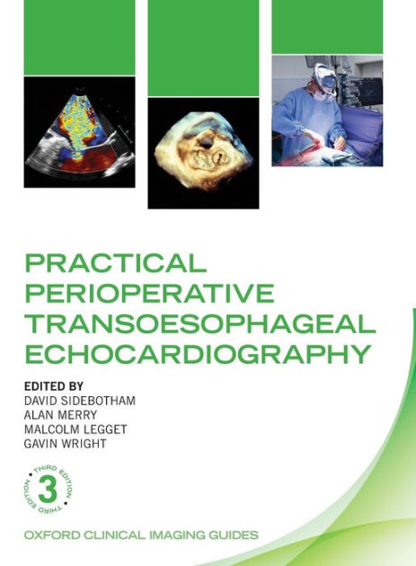 Practical Perioperative Transoesophageal Echocardiography