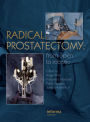 Radical Prostatectomy: From Open to Robotic