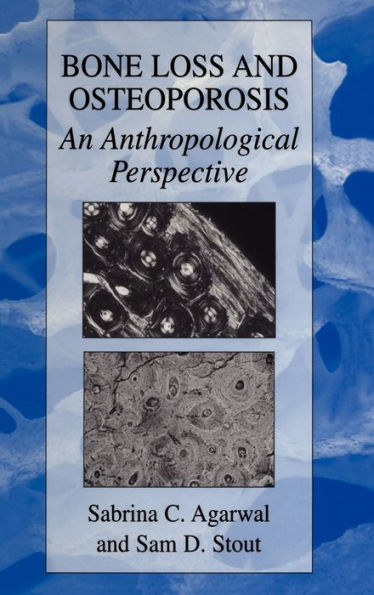 Bone Loss and Osteoporosis: An Anthropological Perspective / Edition 1