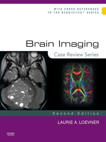 Brain Imaging: Case Review Series: Brain Imaging: Case Review Series E-Book