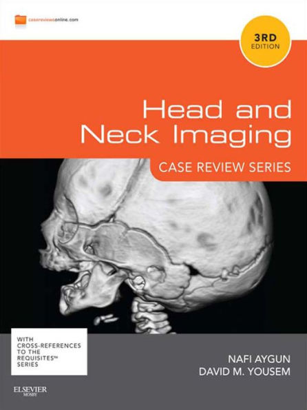 Head & Neck Imaging: Case Review Series