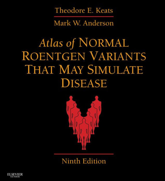 Atlas of Normal Roentgen Variants That May Simulate Disease: Expert
