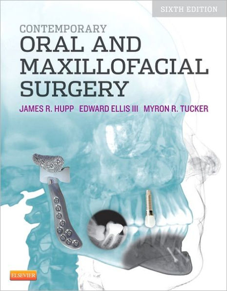 Contemporary Oral and Maxillofacial Surgery / Edition 6