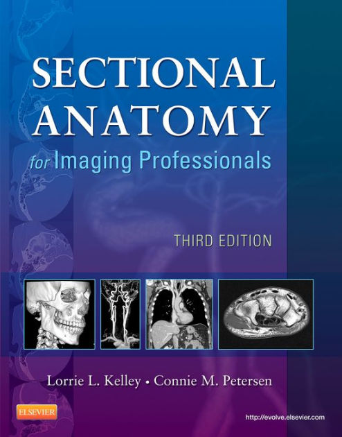 Sectional Anatomy For Imaging Professionals - E-Book: Sectional Anatomy ...