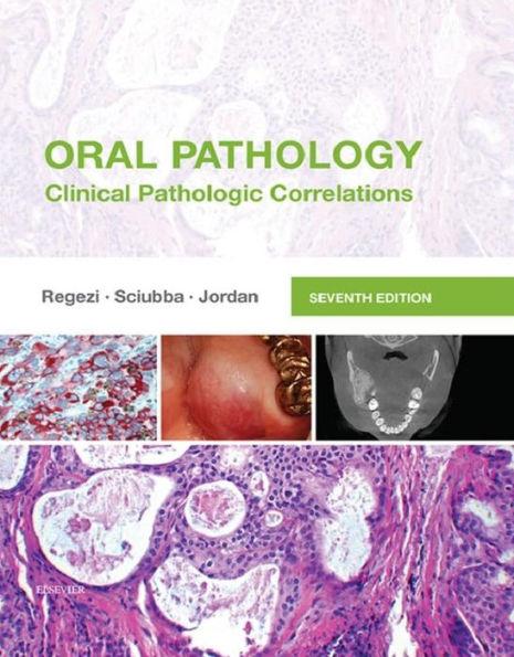 Oral Pathology - E-Book: Oral Pathology - E-Book