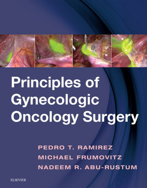 Principles Of Gynecologic Oncology Surgery By Pedro T. Ramirez MD ...