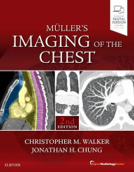 Title: Muller's Imaging of the Chest: Expert Radiology Series / Edition 2, Author: Christopher M. Walker MD