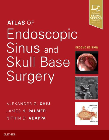 Atlas of Endoscopic Sinus and Skull Base Surgery / Edition 2