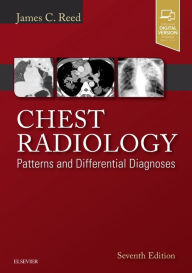 Title: Chest Radiology: Patterns and Differential Diagnoses / Edition 7, Author: James C. Reed MD