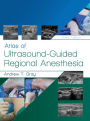 Atlas of Ultrasound-Guided Regional Anesthesia