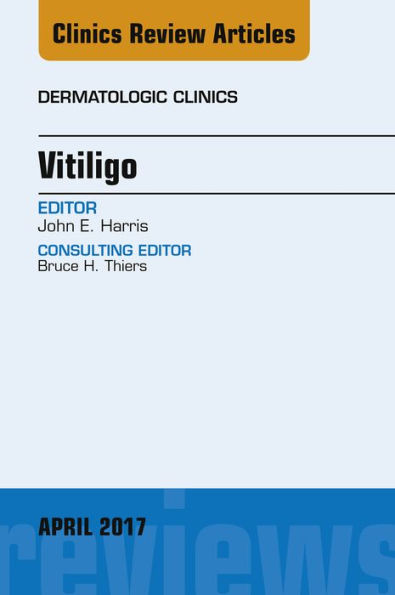 Vitiligo, An Issue of Dermatologic Clinics