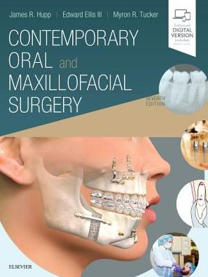 Contemporary Oral And Maxillofacial Surgery Edition 7 By James R