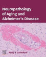 Neuropathology of Aging and Alzheimer's Disease