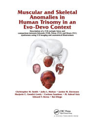 Title: Muscular and Skeletal Anomalies in Human Trisomy in an Evo-Devo Context: Description of a T18 Cyclopic Fetus and Comparison Between Edwards (T18), Patau (T13) and Down (T21) Syndromes Using 3-D Imaging and Anatomical Illustrations / Edition 1, Author: Rui Diogo