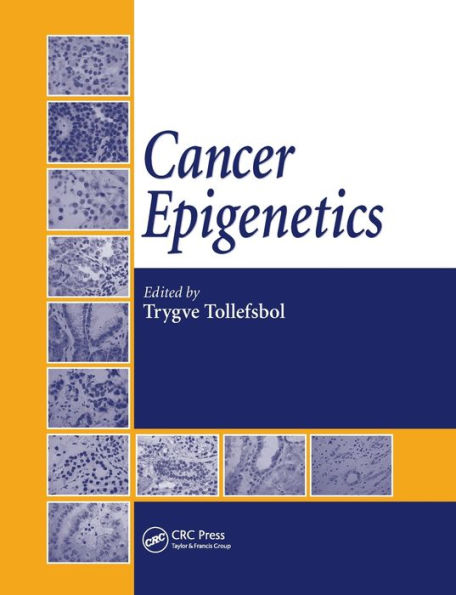 Cancer Epigenetics / Edition 1