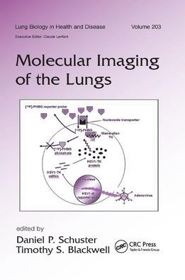 Molecular Imaging of the Lungs / Edition 1