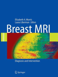 Title: Breast MRI: Diagnosis and Intervention / Edition 1, Author: Laura Liberman