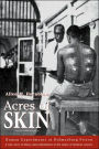 Acres of Skin: Human Experiments at Holmesburg Prison / Edition 1