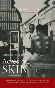 Title: Acres of Skin: Human Experiments at Holmesburg Prison / Edition 1, Author: Allen M. Hornblum