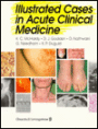 Illustrated Cases in Acute Clinical Medicine / Edition 1