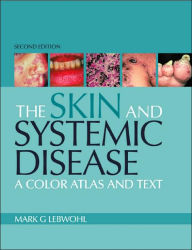 The Skin and Systemic Disease: A Color Atlas and Text / Edition 2
