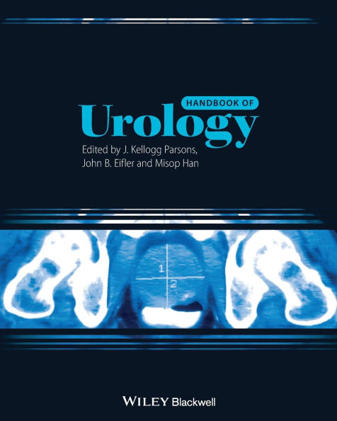 Handbook of Urology