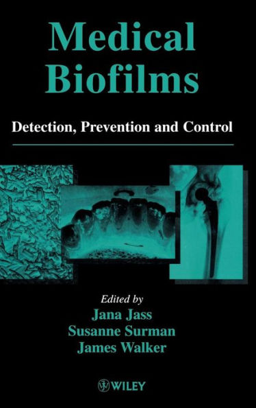 Medical Biofilms: Detection, Prevention and Control / Edition 1