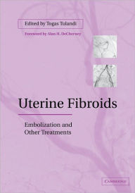 Title: Uterine Fibroids: Embolization and other Treatments, Author: Togas Tulandi