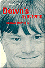 Down's Syndrome: Children Growing Up / Edition 1