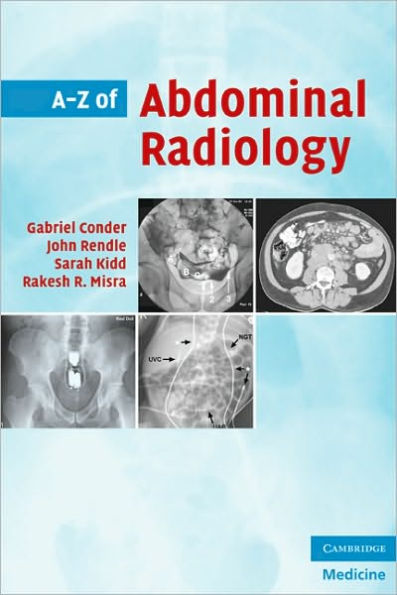 A-Z of Abdominal Radiology