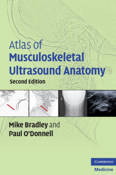 Atlas of Musculoskeletal Ultrasound Anatomy / Edition 2