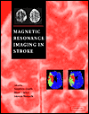 Magnetic Resonance Imaging in Stroke