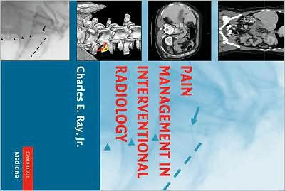 Pain Management In Interventional Radiology / Edition 1 By Charles E ...