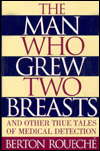 Man Who Grew Two Breasts