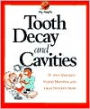 Tooth Decay and Cavities