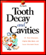 Tooth Decay and Cavities