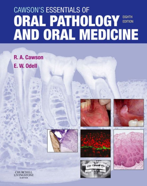 Cawson's Essentials of Oral Pathology and Oral Medicine E-Book: Cawson's Essentials of Oral Pathology and Oral Medicine E-Book