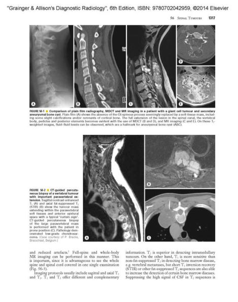 Grainger & Allison's Diagnostic Radiology: 2-Volume Set / Edition 6