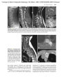 Alternative view 3 of Grainger & Allison's Diagnostic Radiology: 2-Volume Set / Edition 6